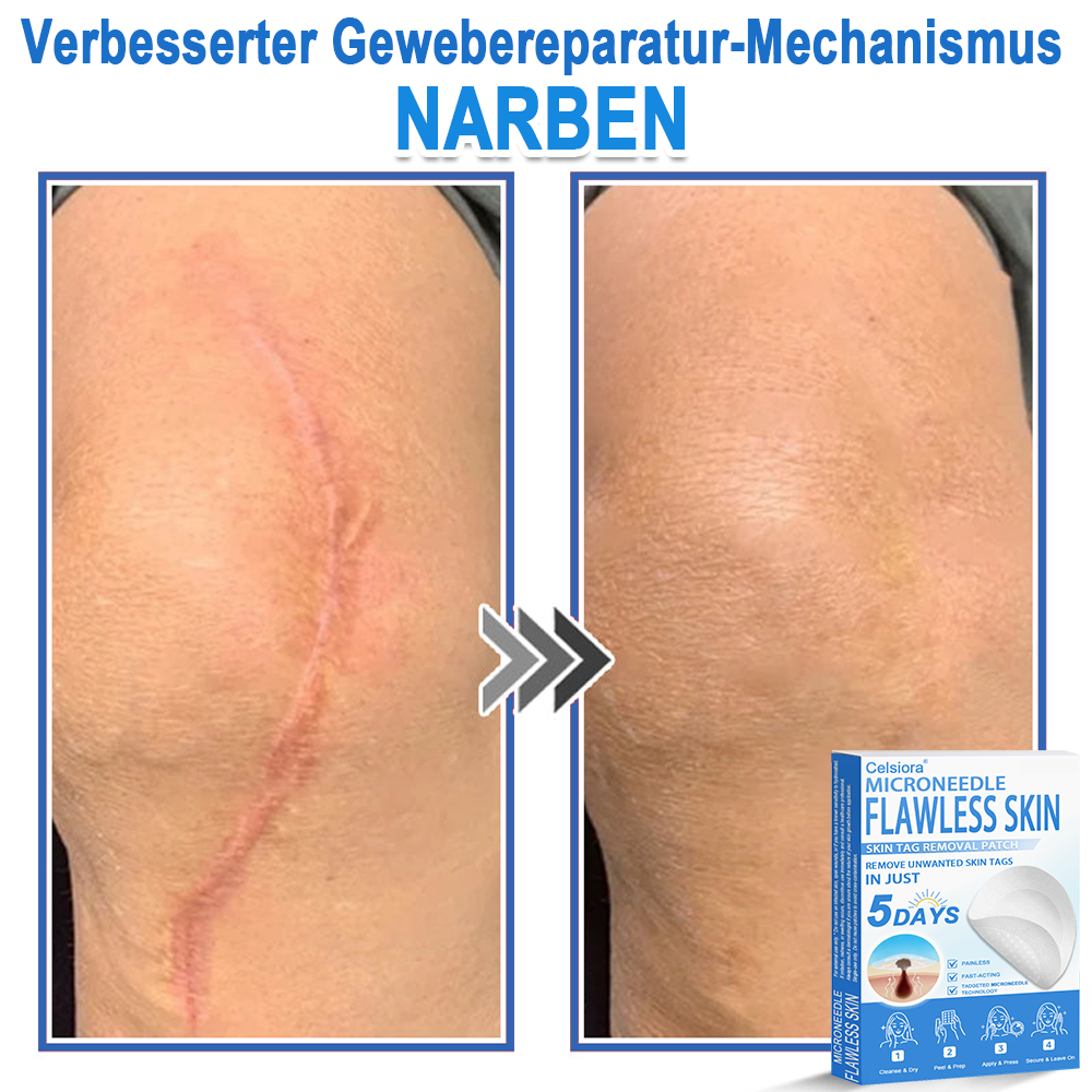 80%OFF 📌 Celsiora® 2-in-1 Mikronadel- & Hydrokolloid-Pflaster | Entferner für erhabene Muttermale, Akne, flache Warzen & Hautanhängsel | Verbessert Falten, Narben & Hautunreinheiten | Unsichtbare Stern-Pickelpflaster für Gesicht & Körper (Copy)