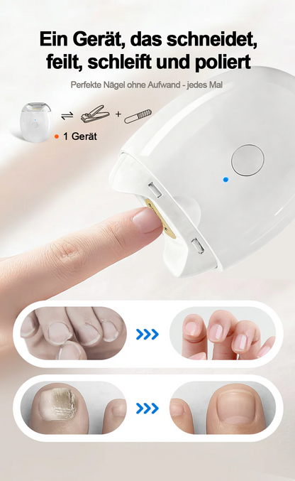 💥LETZTER TAG VERKAUF 50% RABATT💥 Universelle automatische Nagelfeile für Erwachsene und Kinder👶 -Remifa®