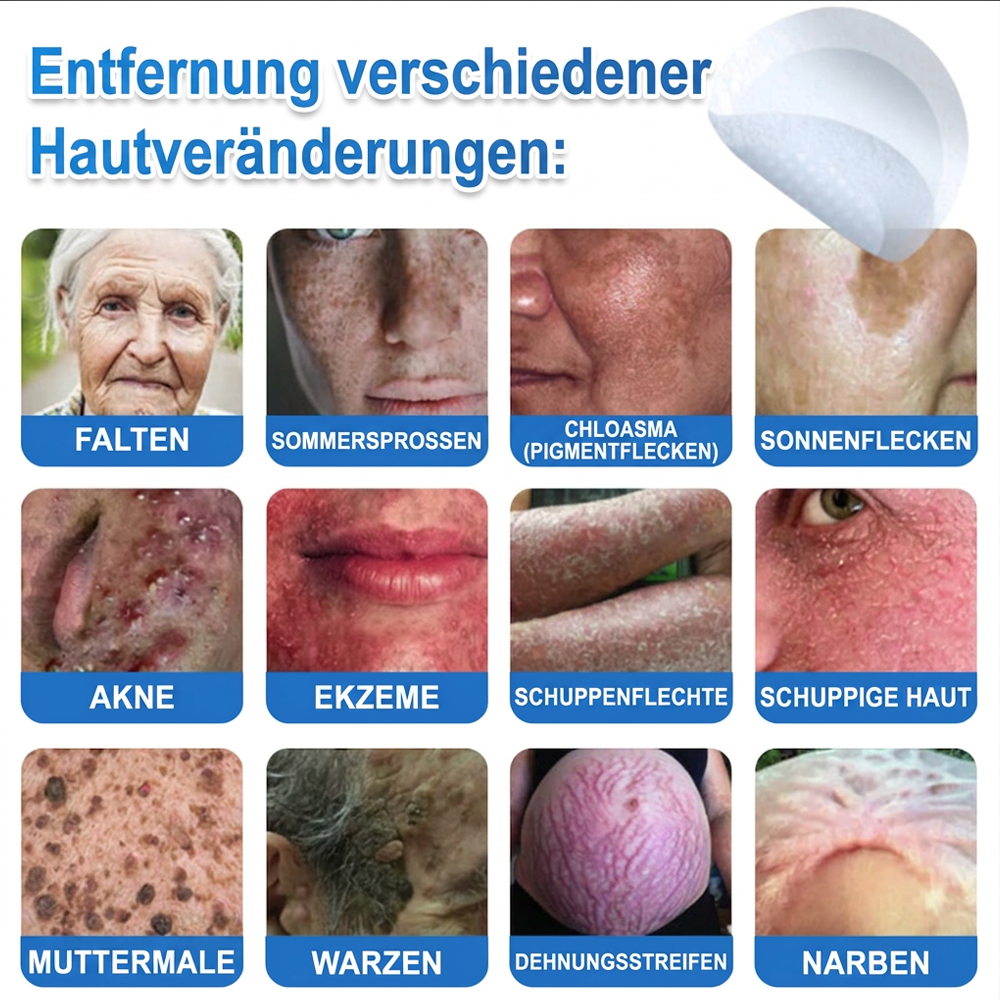 👨‍⚕️Celsiora® 2-in-1 Mikronadel- & Hydrokolloid-Pflaster | Entferner für erhabene Muttermale, Akne, flache Warzen & Hautanhängsel | Verbessert Falten, Narben & Hautunreinheiten | Unsichtbare Stern-Pickelpflaster für Gesicht & Körper