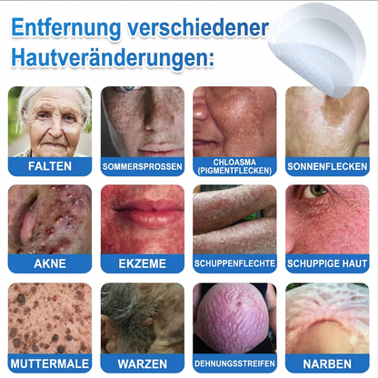 👨‍⚕️Celsiora® 2-in-1 Mikronadel- & Hydrokolloid-Pflaster | Entferner für erhabene Muttermale, Akne, flache Warzen & Hautanhängsel | Verbessert Falten, Narben & Hautunreinheiten | Unsichtbare Stern-Pickelpflaster für Gesicht & Körper