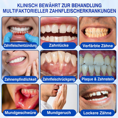 🇩🇪👨‍⚕️✅🦷Evolvion® GumRevive Parodontales Reparaturgel