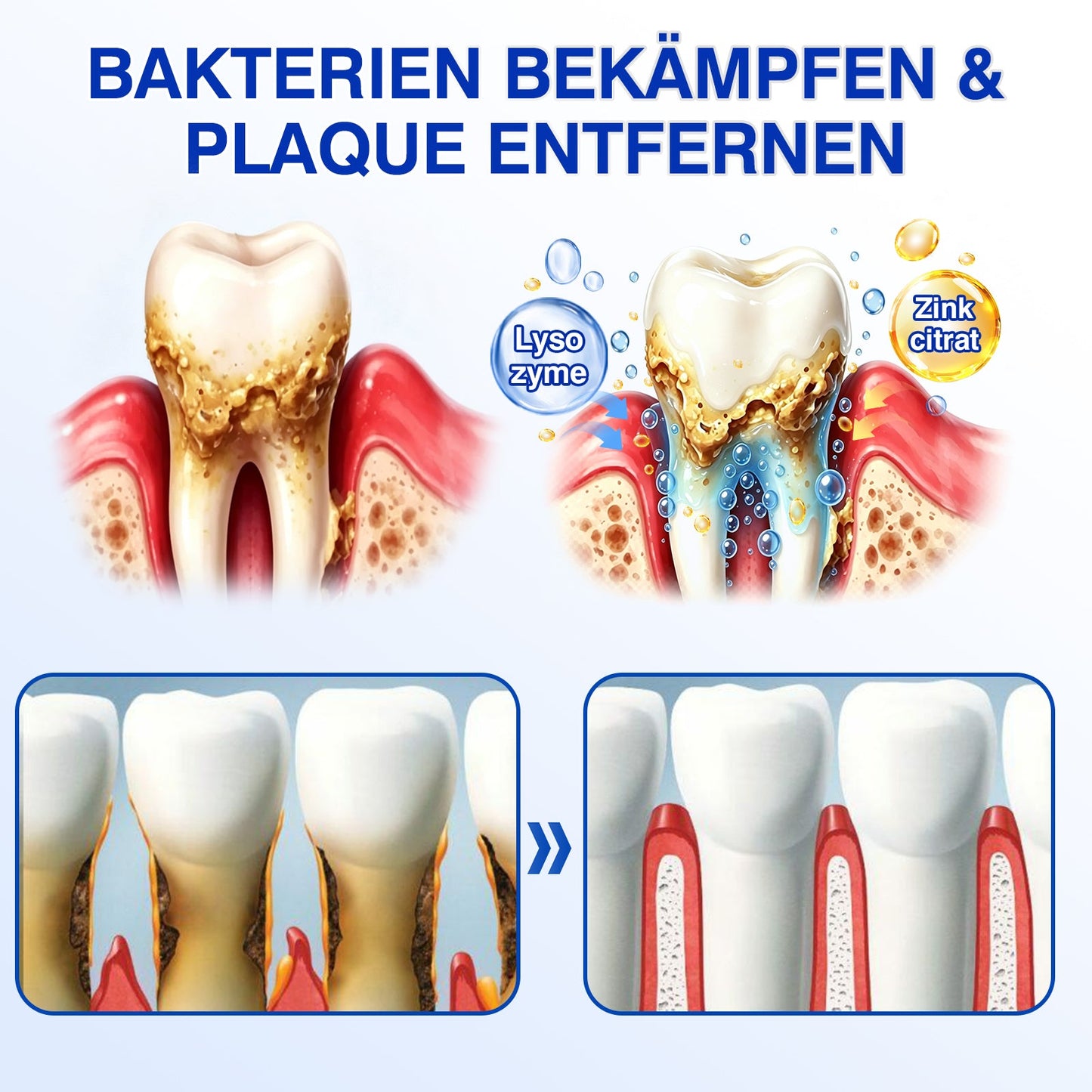 🇩🇪👨‍⚕️✅🦷Evolvion® GumRevive Parodontales Reparaturgel