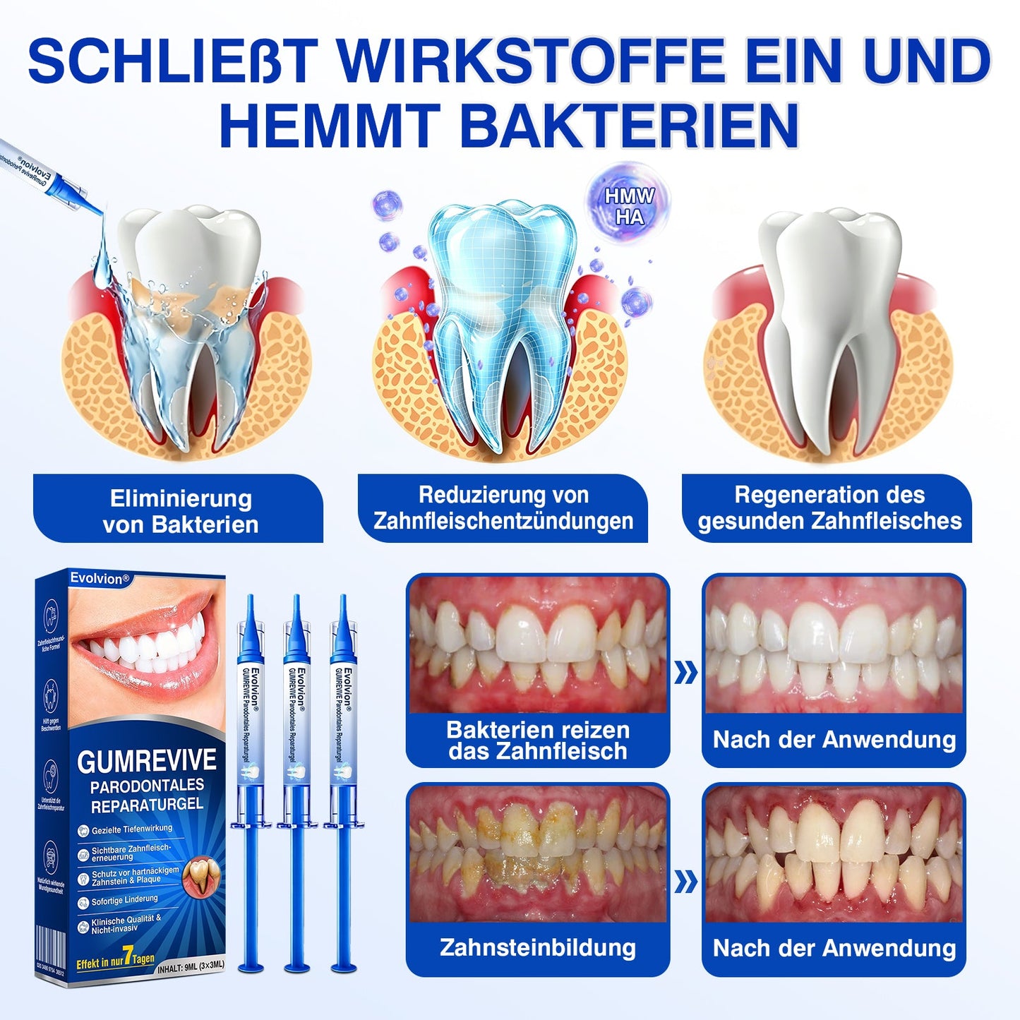 🇩🇪👨‍⚕️✅🦷Evolvion® GumRevive Parodontales Reparaturgel