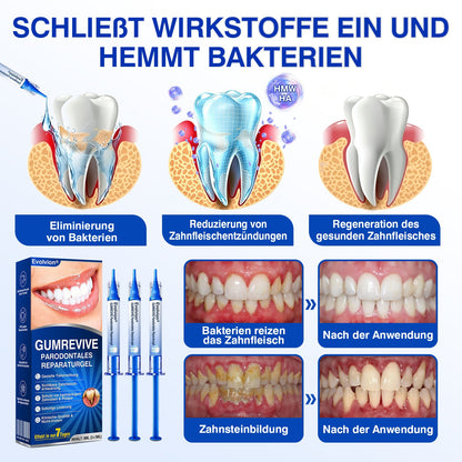🇩🇪👨‍⚕️✅🦷Evolvion® GumRevive Parodontales Reparaturgel