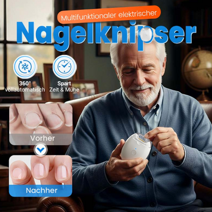 80%OFF💥LETZTER TAG VERKAUF 50% RABATT💥Universeller automatischer Fingernagelschleifer für Erwachsene und Kinder – Einfach & Sicher (Copy) (Copy)