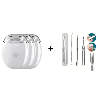 💖LETZTER TAG VERKAUF 50% RABATT💖Universeller automatischer Fingernagelschleifer für Erwachsene und Kinder – Einfach & Sicher -Remifa®