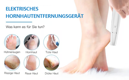 💥 Hot Sale 50% Rabatt💥Elektrischer Hornhautentferner für die Füße👣
