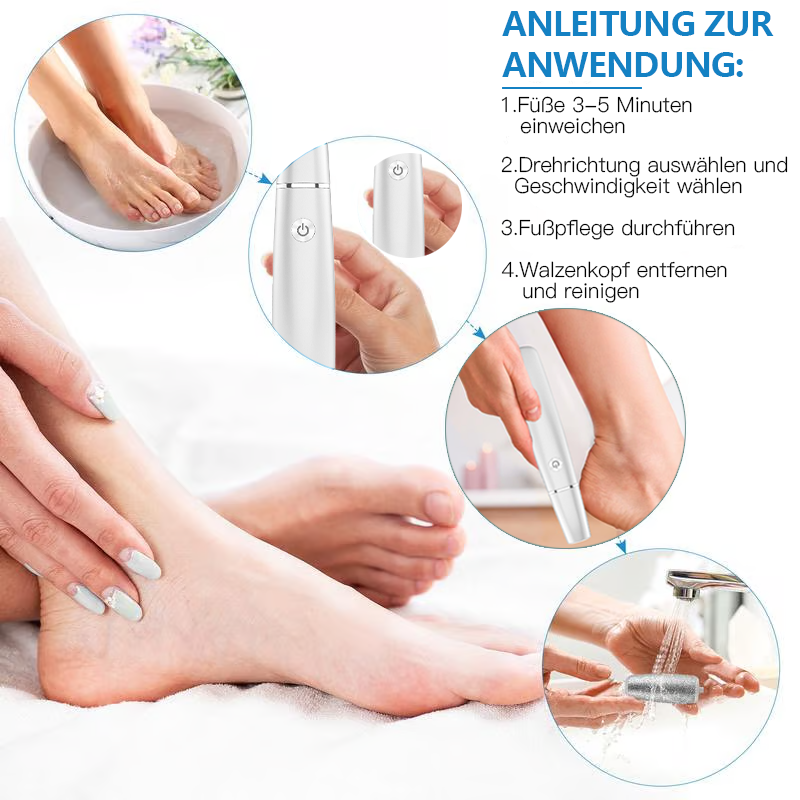 💥 Hot Sale 50% Rabatt💥Elektrischer Hornhautentferner für die Füße👣