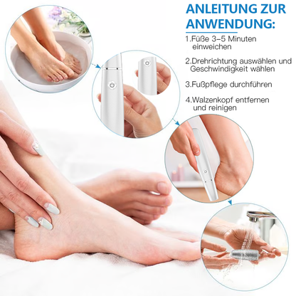 💥 Hot Sale 50% Rabatt💥Elektrischer Hornhautentferner für die Füße👣