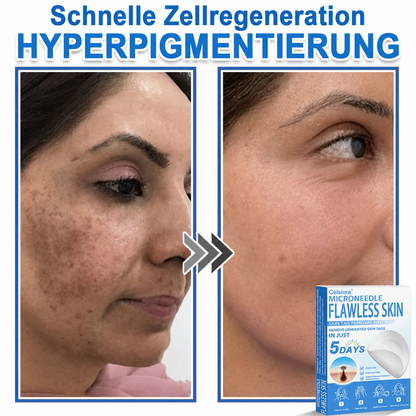 🩹Celsiora® 2-in-1 Mikronadel- & Hydrokolloid-Pflaster | Entferner für erhabene Muttermale, Akne, flache Warzen & Hautanhängsel | Verbessert Falten, Narben & Hautunreinheiten | Unsichtbare Stern-Pickelpflaster für Gesicht & Körper