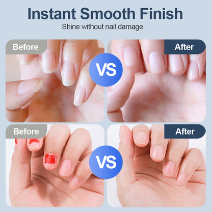 💖LETZTER TAG VERKAUF 50% RABATT💖Universeller automatischer Fingernagelschleifer für Erwachsene und Kinder – Einfach & Sicher -Remifa®
