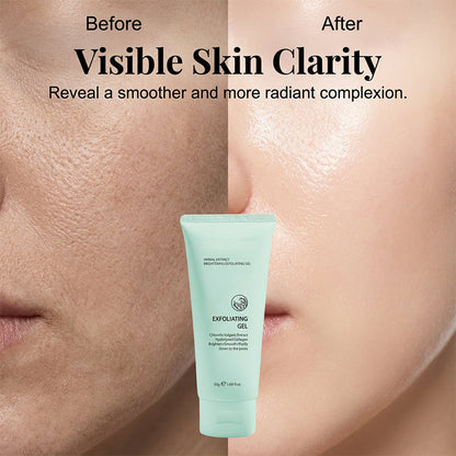 80%OFF-Kräuter-Exfoliating Gel mit Chlorella & Kollagen – Aufhellendes Peeling für glatte, reine Haut